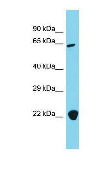 AP4B1 Antibody - Western blot of Human 293T. AP4B1 antibody dilution 1.0 ug/ml.  This image was taken for the unconjugated form of this product. Other forms have not been tested.