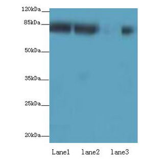AP4B1 Antibody - Western blot. All lanes: AP4B1 antibody at 3 ug/ml. Lane 1: HepG-2 whole cell lysate. Lane 2: U251 whole cell lysate. Lane 3: LO2 whole cell lysate. Secondary Goat polyclonal to Rabbit IgG at 1:10000 dilution. Predicted band size: 83 kDa. Observed band size: 83 kDa.