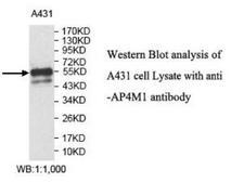 AP4M1 Antibody - Western blot of AP4M1 antibody