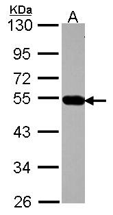 AP4M1 Antibody - Sample (30 ug of whole cell lysate). A: A431 . 10% SDS PAGE. AP4M1 antibody diluted at 1:1000.