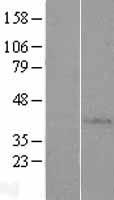 AP4S1 Protein - Western validation with an anti-DDK antibody * L: Control HEK293 lysate R: Over-expression lysate
