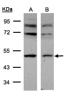 AP50 / AP2M1 Antibody - Sample (30 ug of whole cell lysate). A:293T, B: HeLa S3. 10% SDS PAGE. AP50 / AP2M1 antibody diluted at 1:500