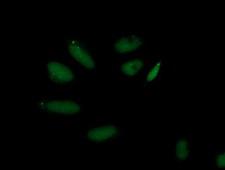 AP50 / AP2M1 Antibody - Immunofluorescent staining of HeLa cells using anti-AP2M1 mouse monoclonal antibody.