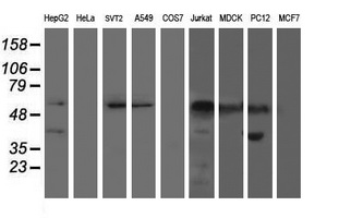 AP50 / AP2M1 Antibody - Western blot of extracts (35ug) from 9 different cell lines by using anti-AP2M1 monoclonal antibody.