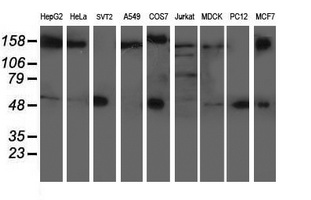 AP50 / AP2M1 Antibody - Western blot of extracts (35ug) from 9 different cell lines by using anti-AP2M1 monoclonal antibody.