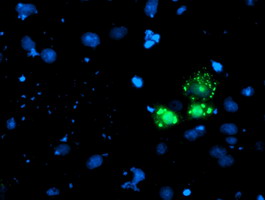 AP50 / AP2M1 Antibody - Anti-AP2M1 mouse monoclonal antibody immunofluorescent staining of COS7 cells transiently transfected by pCMV6-ENTRY AP2M1.