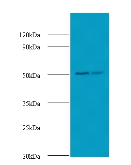 AP50 / AP2M1 Antibody - Western blot of.  This image was taken for the unconjugated form of this product. Other forms have not been tested.