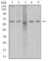 AP50 / AP2M1 Antibody - Western blot analysis using AP2M1 mouse mAb against COS7 (1), SK-Br-3 (2), MCF-7 (3), T47D (4), and HEK293 (5) cell lysate.