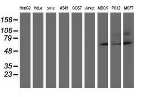 AP50 / AP2M1 Antibody - Western blot of extracts (35 ug) from 9 different cell lines by using anti-AP2M1 monoclonal antibody (HepG2: human; HeLa: human; SVT2: mouse; A549: human; COS7: monkey; Jurkat: human; MDCK: canine; PC12: rat; MCF7: human).