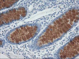 AP50 / AP2M1 Antibody - IHC of paraffin-embedded Human colon tissue using anti-AP2M1 mouse monoclonal antibody.