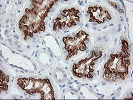 AP50 / AP2M1 Antibody - IHC of paraffin-embedded Human Kidney tissue using anti-AP2M1 mouse monoclonal antibody.