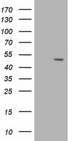 AP50 / AP2M1 Antibody - HEK293T cells were transfected with the pCMV6-ENTRY control (Left lane) or pCMV6-ENTRY AP2M1 (Right lane) cDNA for 48 hrs and lysed. Equivalent amounts of cell lysates (5 ug per lane) were separated by SDS-PAGE and immunoblotted with anti-AP2M1.
