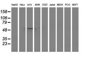 AP50 / AP2M1 Antibody - Western blot of extracts (35 ug) from 9 different cell lines by using anti-AP2M1 monoclonal antibody.