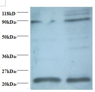 AP50 / AP2M1 Antibody - Western blot of AP-2 complex subunit mu antibody at 2 ug/ml. Lane 1: EC109 whole cell lysate. Lane 2: 293T whole cell lysate. Secondary: Goat polyclonal to Rabbit IgG at 1:15000 dilution. Predicted band size: 48 kDa. Observed band size: 22 kDa Additional bands at: 88 kDa. We are unsure as to the identity of this extra band.  This image was taken for the unconjugated form of this product. Other forms have not been tested.