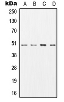 AP50 / AP2M1 Antibody - Western blot analysis of AP2M1 expression in SKBR3 (A); MCF7 (B); mouse brain (C); rat brain (D) whole cell lysates.