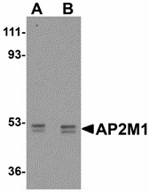 AP50 / AP2M1 Antibody - Western blot of AP2M1 in human kidney tissue lysate with AP2M1 antibody at (A) 1 and (B) 2 ug/ml. Below: Immunohistochemistry of AP2M1 in mouse kidney tissue with AP2M1 antibody at 2.5 ug/ml.