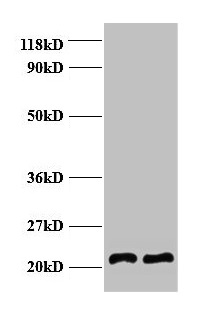 AP50 / AP2M1 Antibody - Western blot All lanes: AP-2 complex subunit mu antibody at 2µg/ml Lane 1: EC109 whole cell lysate Lane 2: 293T whole cell lysate Secondary Goat polyclonal to rabbit IgG at 1/15000 dilution Predicted band size: 48 kDa Observed band size: 22 kDa
