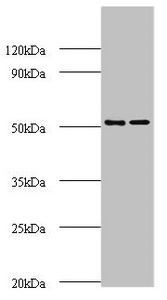 AP50 / AP2M1 Antibody - Western blot All lanes: AP-2 complex subunit mu polyclonal Antibody at 2µg/ml Lane 1: Mouse brain tissue Lane 2: Rat brain tissue Secondary Goat polyclonal to rabbit IgG at 1/10000 dilution Predicted band size: 50 kDa Observed band size: 50 kDa