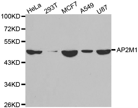 AP50 / AP2M1 Antibody - Western blot analysis of extracts of various cell lines, using AP2M1 antibody.