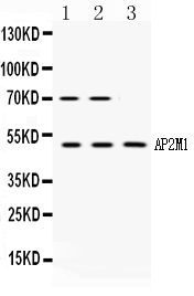 AP50 / AP2M1 Antibody - Western blot - Anti-AP2M1/Ap 2 Mu 1 Picoband Antibody