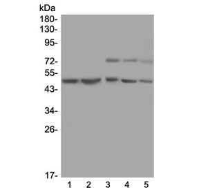 AP50 / AP2M1 Antibody - Western blot testing of 1) rat kidney, 2) mouse NIH3T3 and 3) human MCF7 cell lysate with AP2M1 antibody at 0.5ug/ml. Predicted molecular weight ~50 kDa.