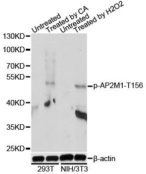 AP50 / AP2M1 Antibody - Western blot analysis of extracts of 293T and NIH/3T3 cells, using Phospho-AP2M1-T156 antibody at 1:1000 dilution. 293T cells were treated by Calyculin A for 30 minutes after serum-starvation overnight.NIH/3T3 cells were treated by Hydrogen Peroxide (2nM) for 15 minutes after serum-starvation overnight. The secondary antibody used was an HRP Goat Anti-Rabbit IgG (H+L) at 1:10000 dilution. Lysates were loaded 25ug per lane and 3% nonfat dry milk in TBST was used for blocking. Blocking buffer: 3% BSA.An ECL Kit was used for detection and the exposure time was 30s.