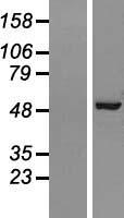 AP50 / AP2M1 Protein - Western validation with an anti-DDK antibody * L: Control HEK293 lysate R: Over-expression lysate
