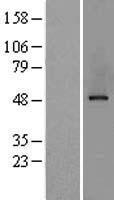 AP50 / AP2M1 Protein - Western validation with an anti-DDK antibody * L: Control HEK293 lysate R: Over-expression lysate