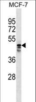 AP5M1 / C14orf108 Antibody - MUDEN Antibody western blot of MCF-7 cell line lysates (35 ug/lane). The MUDEN antibody detected the MUDEN protein (arrow).