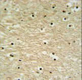 AP5Z1 Antibody - K0415 Antibody IHC of formalin-fixed and paraffin-embedded human brain tissue followed by peroxidase-conjugated secondary antibody and DAB staining.