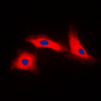 APAF1 / APAF-1 Antibody - Immunofluorescent analysis of APAF-1 staining in HeLa cells. Formalin-fixed cells were permeabilized with 0.1% Triton X-100 in TBS for 5-10 minutes and blocked with 3% BSA-PBS for 30 minutes at room temperature. Cells were probed with the primary antibody in 3% BSA-PBS and incubated overnight at 4 C in a humidified chamber. Cells were washed with PBST and incubated with a DyLight 594-conjugated secondary antibody (red) in PBS at room temperature in the dark. DAPI was used to stain the cell nuclei (blue).