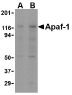 APAF1 / APAF-1 Antibody - Western blot of Apaf1 in K562 cell lysate with Apaf1 antibody at (A) 0.25 and (B) 0.5 mg/ml. Below: Immunohistochemistry of Apaf1 in K562 cells with Apaf1 antibody at 0.5 ug/ml.