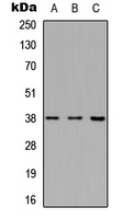 APAF1 / APAF-1 Antibody - Western blot analysis of APAF-1 expression in HeLa (A); Raw264.7 (B); PC12 (C) whole cell lysates.