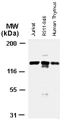 APAF1 / APAF-1 Antibody - Western blot of Apaf 1 using APAF1 / APAF-1 at 1:2000. Jurkat: human T-cell leukemia cell line lysate. RS11-846: human B-cell leukemia cell line lysate. Human thymus: tissue lysate.