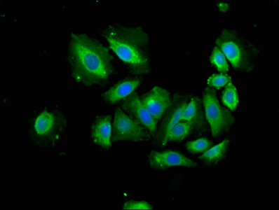 APAF1 / APAF-1 Antibody - Immunofluorescence staining of A549 cells with APAF1 Antibody at 1:166, counter-stained with DAPI. The cells were fixed in 4% formaldehyde, permeabilized using 0.2% Triton X-100 and blocked in 10% normal Goat Serum. The cells were then incubated with the antibody overnight at 4°C. The secondary antibody was Alexa Fluor 488-congugated AffiniPure Goat Anti-Rabbit IgG(H+L).