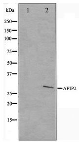APAF1 / APAF-1 Antibody - Western blot of COLO205 cell lysate using APAF1 Antibody