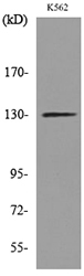 APAF1 / APAF-1 Antibody - Western blot analysis of lysate from K562 cells, using APAF1 Antibody.