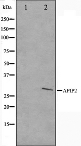 APAF1 / APAF-1 Antibody - Western blot analysis on COLO205 cell lysates using APAF1 antibody. The lane on the left is treated with the antigen-specific peptide.