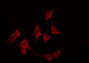 APAF1 / APAF-1 Antibody - Staining COLO205 cells by IF/ICC. The samples were fixed with PFA and permeabilized in 0.1% Triton X-100, then blocked in 10% serum for 45 min at 25°C. The primary antibody was diluted at 1:200 and incubated with the sample for 1 hour at 37°C. An Alexa Fluor 594 conjugated goat anti-rabbit IgG (H+L) Ab, diluted at 1/600, was used as the secondary antibody.