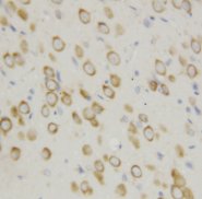 APAF1 / APAF-1 Antibody -  This image was taken for the unconjugated form of this product. Other forms have not been tested.