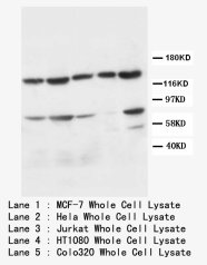 APAF1 / APAF-1 Antibody -  This image was taken for the unconjugated form of this product. Other forms have not been tested.