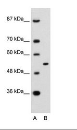 APBA1 / MINT1 Antibody - A: Marker, B: Rap Cell Lysate.  This image was taken for the unconjugated form of this product. Other forms have not been tested.
