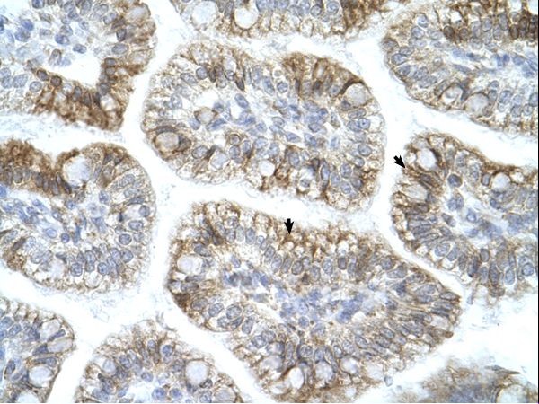 APBA1 / MINT1 Antibody - APBA1 antibody AVARP13059_P050-EAW62487-APBA1(amyloid beta (A4) precursor protein-binding, family A, member 1 (X11)) Antibody was used in IHC to stain formalin-fixed, paraffin-embedded human intestine.  This image was taken for the unconjugated form of this product. Other forms have not been tested.