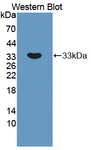 APBA2 Antibody - Western blot of APBA2 antibody.