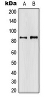 APBA2 Antibody - Western blot analysis of APBA2 expression in H4 (A); HeLa (B) whole cell lysates.