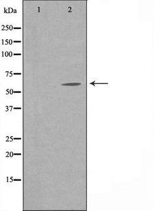 APBA3 / MINT3 Antibody - Western blot analysis of extracts of HuvEc cells using APBA3 antibody. The lane on the left is treated with the antigen-specific peptide.