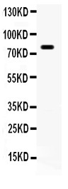 APBB1 / FE65 Antibody - FE65 antibody Western blot. All lanes: Anti at 0.5 ug/ml. WB: Mouse Brain Tissue Lysate at 50 ug. Predicted band size: 77 kD. Observed band size: 77 kD.