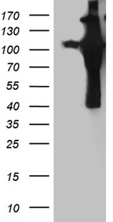 APBB1 / FE65 Antibody - HEK293T cells were transfected with the pCMV6-ENTRY control. (Left lane) or pCMV6-ENTRY APBB1. (Right lane) cDNA for 48 hrs and lysed
