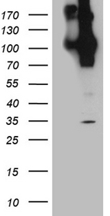 APBB1 / FE65 Antibody - HEK293T cells were transfected with the pCMV6-ENTRY control. (Left lane) or pCMV6-ENTRY APBB1. (Right lane) cDNA for 48 hrs and lysed