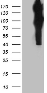 APBB1 / FE65 Antibody - HEK293T cells were transfected with the pCMV6-ENTRY control. (Left lane) or pCMV6-ENTRY APBB1. (Right lane) cDNA for 48 hrs and lysed. Equivalent amounts of cell lysates. (5 ug per lane) were separated by SDS-PAGE and immunoblotted with anti-APBB1. (1:2000)